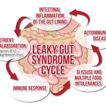 Simple Tips For Treating Leaky Gut Syndrome Efficiently